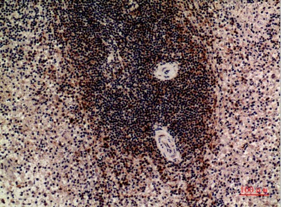 Fig2:; Immunohistochemical analysis of paraffin-embedded human-spleen, antibody was diluted at 1:100