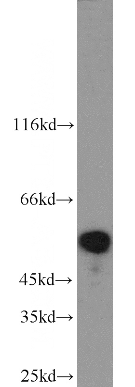 HEK-293 cells were subjected to SDS PAGE followed by western blot with Catalog No:112249(STK11 antibody) at dilution of 1:600