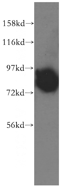 HEK-293 cells were subjected to SDS PAGE followed by western blot with Catalog No:113095(NEDD1 antibody) at dilution of 1:800