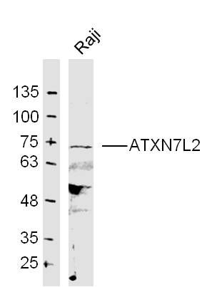 Fig1: Sample:; Raji Cell (Human) Lysate at 30 ug; Primary: Anti- ATXN7L2 at 1/300 dilution; Secondary: IRDye800CW Goat Anti-Rabbit IgG at 1/20000 dilution; Predicted band size: 77 kD; Observed band size: 74 kD
