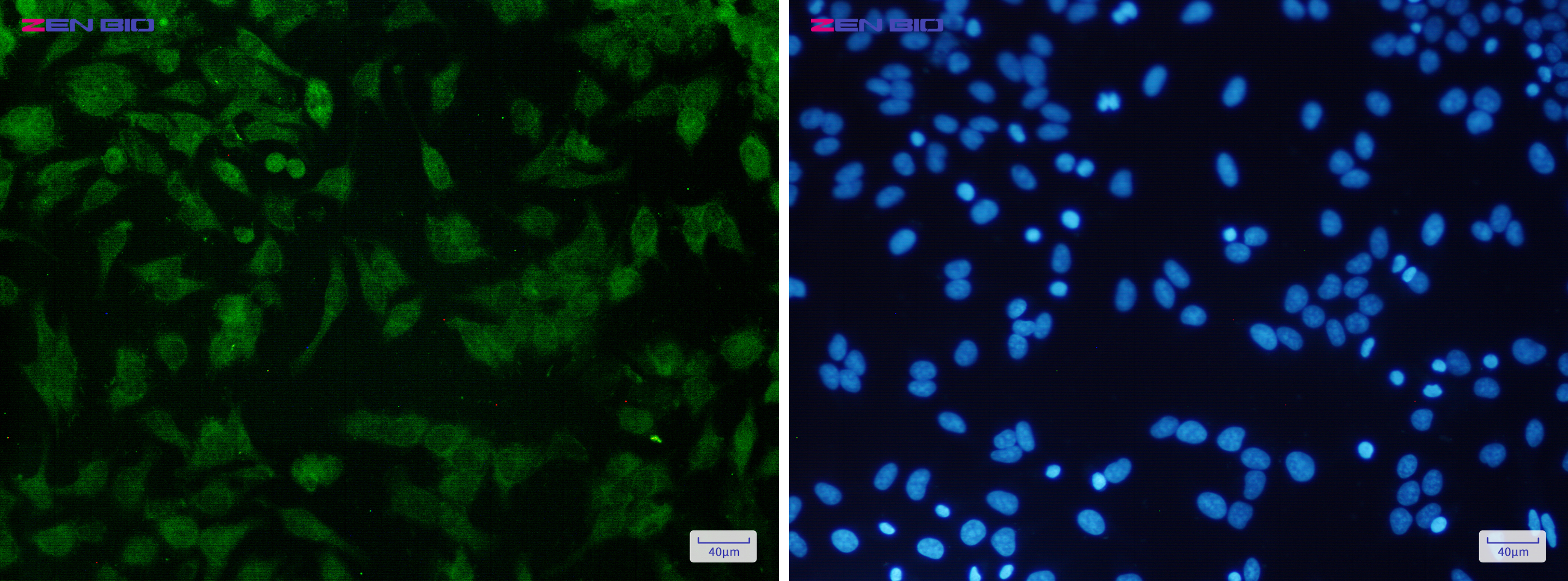 Immunocytochemistry of CDKN2A/p16INK4a(green) in Hela cells using CDKN2A/p16INK4a Rabbit pAb at dilution 1/50, and DAPI(blue)