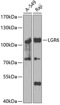 Western blot - LGR6 Polyclonal Antibody 