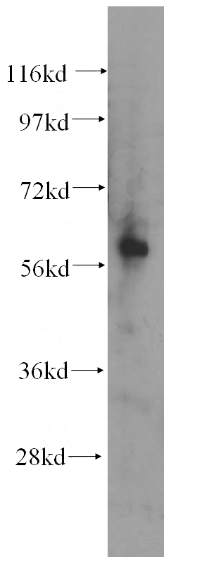 Y79 cells were subjected to SDS PAGE followed by western blot with Catalog No:107993(AMIGO2 antibody) at dilution of 1:500