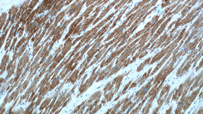 Immunohistochemical of paraffin-embedded human heart using Catalog No:109484(COX15 antibody) at dilution of 1:100 (under 10x lens)