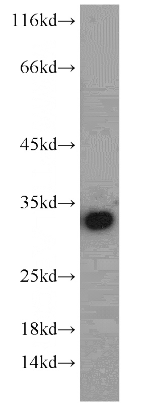 A549 cells were subjected to SDS PAGE followed by western blot with Catalog No:111126(GPR35 antibody) at dilution of 1:600