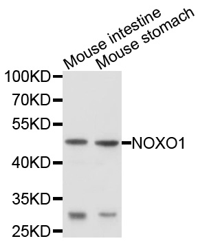 Western blot - NOXO1 Polyclonal Antibody 