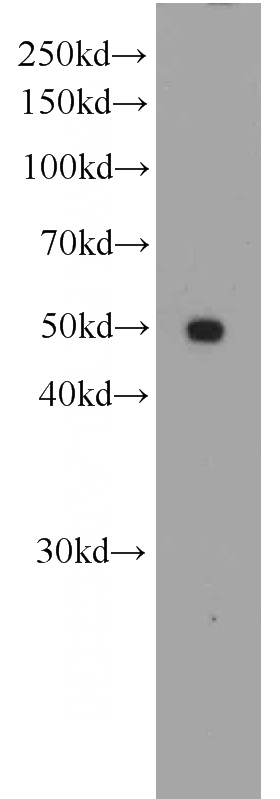 SKOV-3 cells were subjected to SDS PAGE followed by western blot with Catalog No:107455(PAX8-Specific antibody) at dilution of 1:500