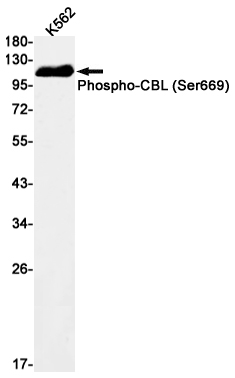 Western blot detection of Phospho-CBL (Ser669) in K562 cell lysates using Phospho-CBL (Ser669) Rabbit mAb(1:1000 diluted).Predicted band size:100kDa.Observed band size:120kDa.