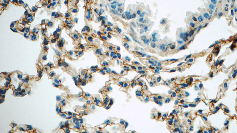 Immunohistochemistry of paraffin-embedded mouse lung tissue slide using Catalog No:111588(ICAM-1 Antibody) at dilution of 1:50 (under 40x lens)