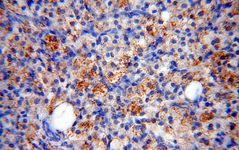Immunohistochemical of paraffin-embedded human ovary using Catalog No:108642(C11orf67 antibody) at dilution of 1:50 (under 40x lens)