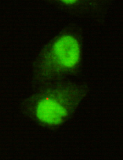 Immunocytochemistry of HeLa cells using anti-KDM5C / Jarid1C / SMCX mouse mAb diluted 1:150.
