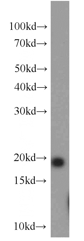 mouse brain tissue were subjected to SDS PAGE followed by western blot with Catalog No:113026(NCALD antibody) at dilution of 1:2000