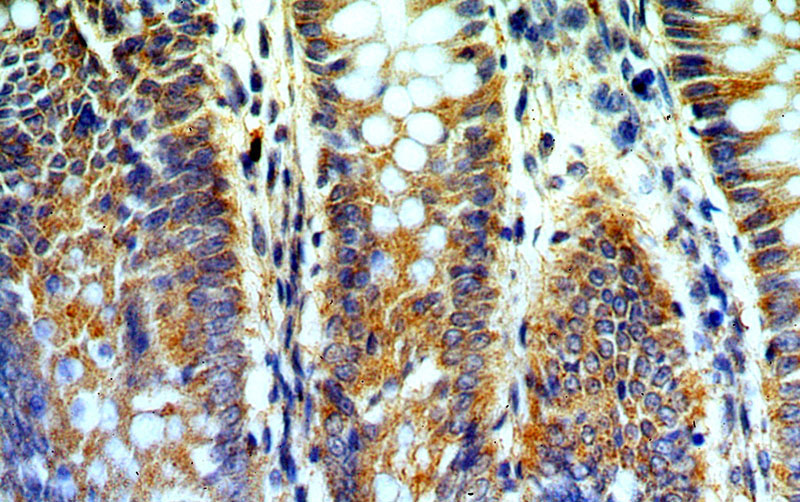 Immunohistochemical of paraffin-embedded human colon using Catalog No:108396(B4GALT6 antibody) at dilution of 1:100 (under 40x lens)