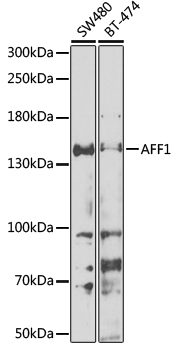 Western blot - AFF1 Polyclonal Antibody 