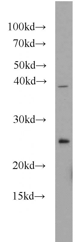 mouse liver tissue were subjected to SDS PAGE followed by western blot with Catalog No:116087(TMED4 antibody) at dilution of 1:1000