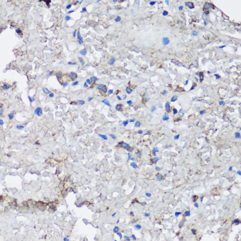 Immunohistochemistry - NLRC4 Polyclonal Antibody 