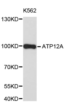 Western blot - ATP12A Polyclonal Antibody 