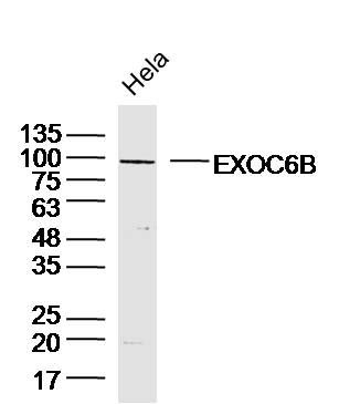 Fig1: Sample:Hela (Human)Cell Lysate at 40 ug; Primary: Anti-EXOC6B at 1/300 dilution; Secondary: IRDye800CW Goat Anti-RabbitIgG at 1/20000 dilution; Predicted band size: 94kD; Observed band size: 94kD