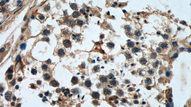 Immunohistochemistry of paraffin-embedded human testis tissue slide using Catalog No:112330(LRRC20 Antibody) at dilution of 1:50 (under 40x lens)