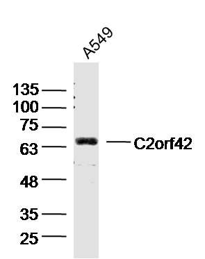 Fig1: Sample: A549 Cell (Human) Lysate at 30 ug; Primary: Anti- C2orf42 at 1/300 dilution; Secondary: IRDye800CW Goat Anti-Rabbit IgG at 1/20000 dilution; Predicted band size: 64kD; Observed band size: 64kD