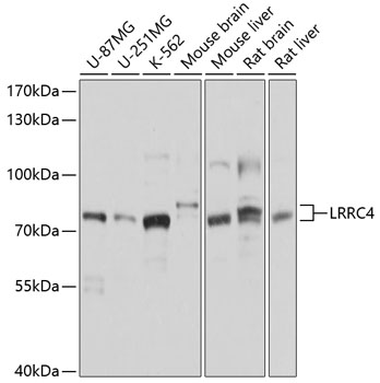 Western blot - LRRC4 Polyclonal Antibody 