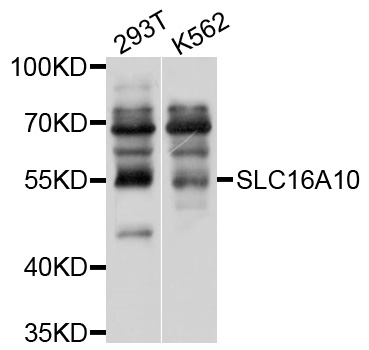 Western blot - SLC16A10 Polyclonal Antibody 