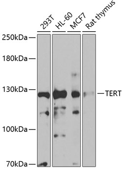 Western blot - TERT Polyclonal Antibody 