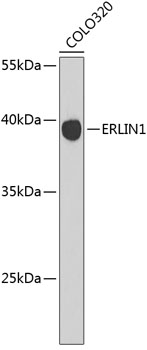 Western blot - ERLIN1 Polyclonal Antibody 
