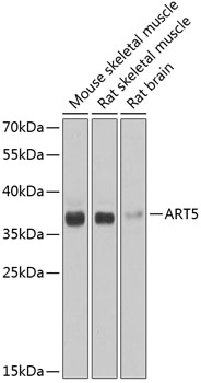 Western blot - ART5 Polyclonal Antibody 