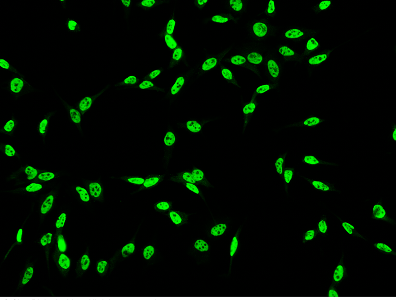 Human DDX5 Immunofluorescence(IF) 15149