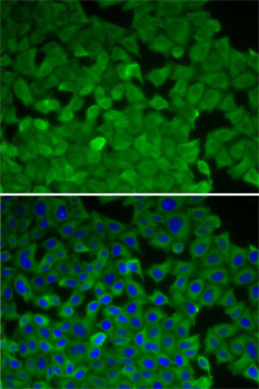 Immunofluorescence - EEF2K Polyclonal Antibody 