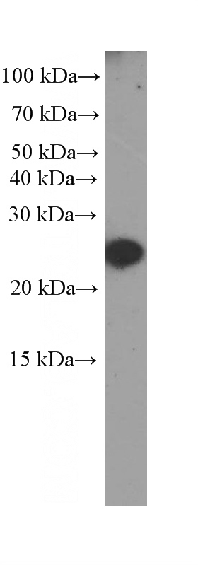 Serum from mouse injected with bacteria were subjected to SDS PAGE followed by western blot with Catalog No:107177 (CRP Antibody) at dilution of 1:2000. Horseradish peroxidase conjugated protein A was used for signal developing instead of secondary antibody.