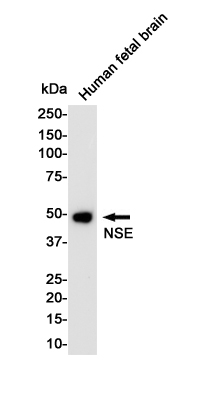 Western blot detection of NSE in Human Fetal Brain lysates using NSE Rabbit pAb(1:1000 diluted).Predicted band size:47KDa.Observed band size:47KDa.