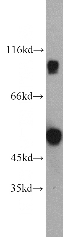 human testis tissue were subjected to SDS PAGE followed by western blot with Catalog No:108756(CABYR antibody) at dilution of 1:500