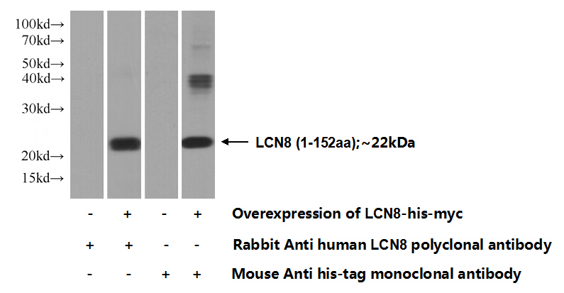 Transfected HEK-293 cells were subjected to SDS PAGE followed by western blot with Catalog No:112174(LCN8 Antibody) at dilution of 1:1000