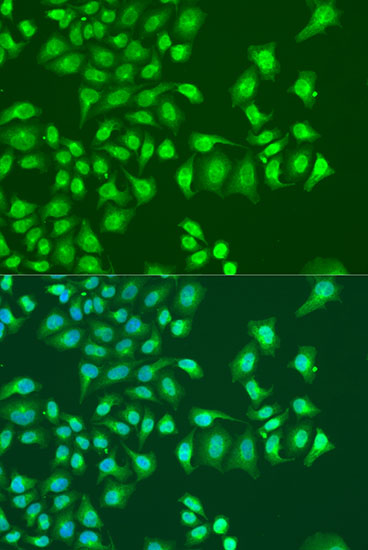 Immunofluorescence - NIN Polyclonal Antibody 