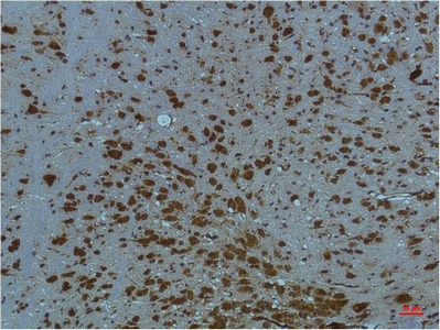 Immunohistochemical analysis of paraffin-embedded Mouse BrainTissue using PI3 Kinase P85 α Mouse mAb diluted at 1:200.