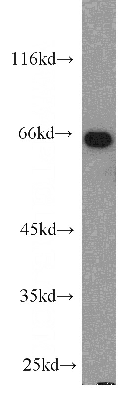 HeLa cells were subjected to SDS PAGE followed by western blot with Catalog No:117329(LMNB1 antibody) at dilution of 1:1000