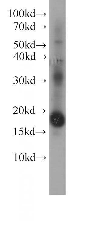 K-562 cells were subjected to SDS PAGE followed by western blot with Catalog No:107552(4EBP1 antibody) at dilution of 1:2000