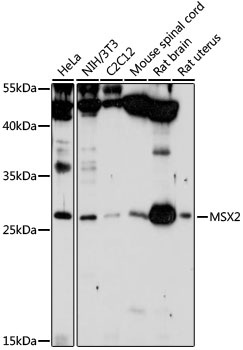 Western blot - MSX2 Polyclonal Antibody 
