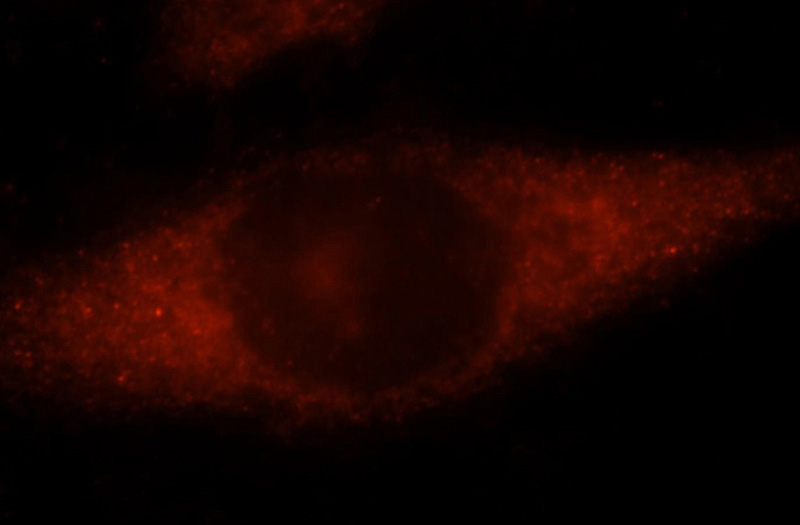 Immunofluorescent analysis of Hela cells, using DIRAS2 antibody Catalog No:109945 at 1:25 dilution and Rhodamine-labeled goat anti-rabbit IgG (red).