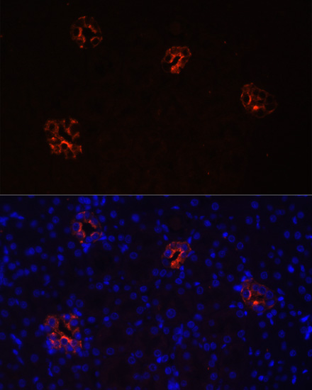 Immunofluorescence - AQP2 Polyclonal Antibody 