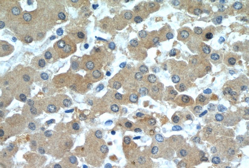 Immunohistochemistry of paraffin-embedded human liver slide using Catalog No:112318(LRG1 Antibody) at dilution of 1:50