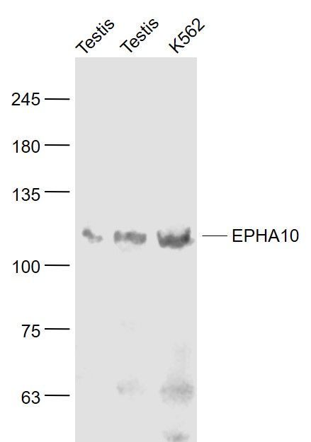 Fig2: Sample:; Testis (Mouse) Lysate at 40 ug; Testis (Rat) Lysate at 40 ug; K562(Human) Cell Lysate at 30 ug; Primary: Anti- EPHA10 at 1/1000 dilution; Secondary: IRDye800CW Goat Anti-Rabbit IgG at 1/20000 dilution; Predicted band size: 107 kD; Observed band size: 107 kD
