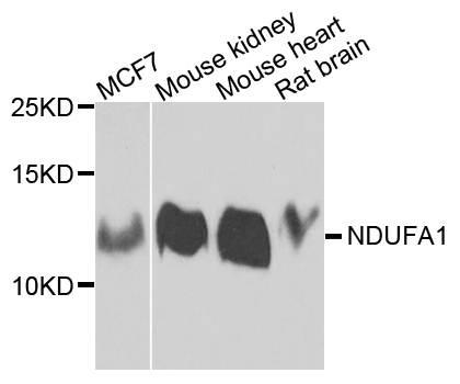 Western blot - NDUFA1 Polyclonal Antibody 