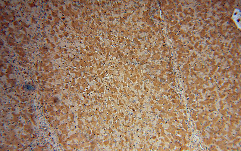 Immunohistochemical of paraffin-embedded human liver using Catalog No:107955(ALB antibody) at dilution of 1:100 (under 10x lens)