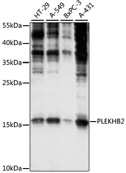 Western blot - PLEKHB2 Polyclonal Antibody 