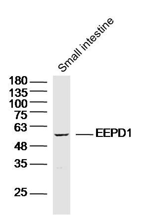 Fig2: Sample: Small intestine (Mouse) Lysate at 40 ug; Primary: Anti-EEPD1 at 1/300 dilution; Secondary: IRDye800CW Goat Anti-Rabbit IgG at 1/20000 dilution; Predicted band size: 62 kD; Observed band size: 60 kD