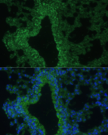 Immunofluorescence - IL25 Polyclonal Antibody 
