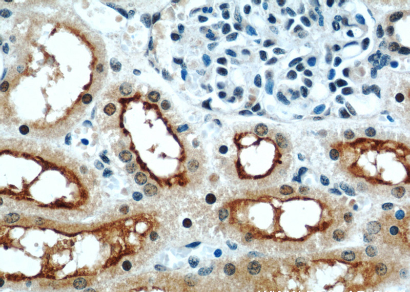 Immunohistochemistry of paraffin-embedded human kidney slide using Catalog No:117159(ZNF311 Antibody) at dilution of 1:50